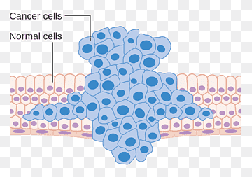 neoplasia de metástasis de células cancerosas, diversas células cancerosas, diverso, azul, célula png thumbnail