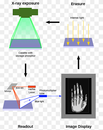 stimulated luminescence Computed Radiography Industrial computed tomography, others, angle, text, xray png thumbnail